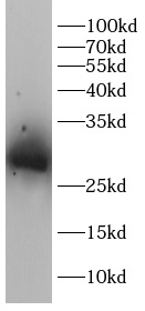 anti-GCLM antibody