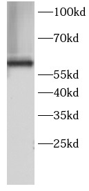 anti-HSP60 antibody