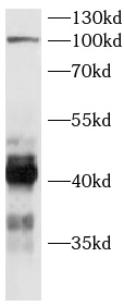 anti-SHARPIN antibody