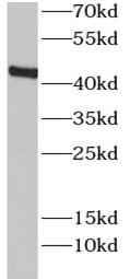 anti-CNR2 antibody