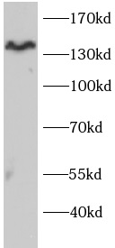      anti-SHIP2 antibody