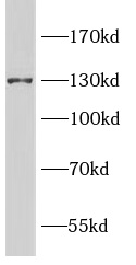      anti-IRE1 antibody