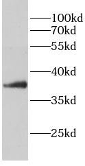 anti-PP1A antibody