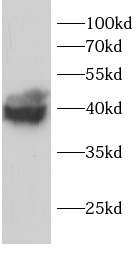 anti-PP1G antibody