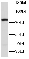      anti-SLC6A4 antibody