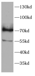 anti-IRF7 antibody