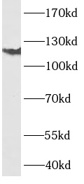 Integrin alpha 6抗体