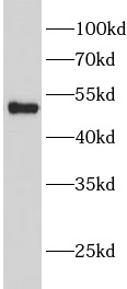      anti-GSS antibody