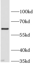      anti-GLUT9 antibody