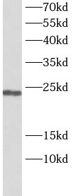 anti-Securin / PTTG1 antibody