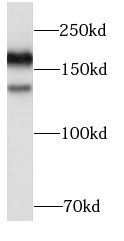      anti-EGFR antibody