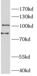      anti-PTN3 antibody