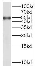 anti-akt1 antibody