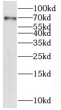      anti-irak2 antibody