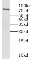 anti-ikke antibody