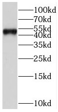 anti-jnk antibody