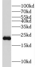 anti-rask antibody