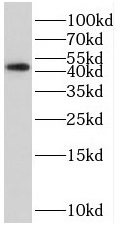 anti-mek2 antibody