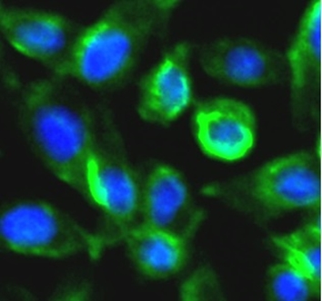      anti-RIP1 antibody