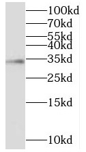 anti-IBP2 antibody