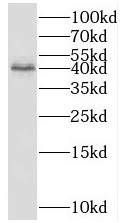 anti-FUCO2 antibody