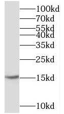 anti-CST3 antibody