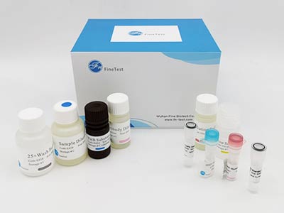 兔基质金属蛋白酶抑制因子1(TIMP-1)酶联免疫(elisa)试剂盒