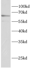 anti-ETV6 antibody