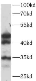 anti-SHBG antibody