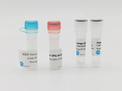 人转铁蛋白受体2(TFR2)酶联免疫吸附测定(elisa)试剂盒