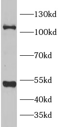      anti-IDE antibody