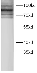 anti-KS6A1 antibody