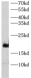      anti-CAV3 antibody