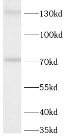 anti-NOS3 antibody