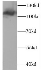      anti-CLCN1 antibody