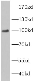      anti-EWSR1 antibody