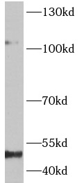      anti-NFKB1 antibody