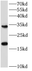 anti- 4EBP1 antibody