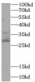 anti- ABC3A antibody