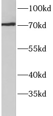      anti-ACSS3 antibody