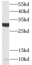      anti- ACRV1 antibody