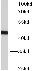 anti- ACTL7B antibody