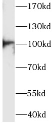 anti-ACTN3 antibody