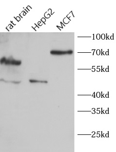      anti- ACVR1B antibody