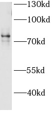      anti- ACSL4/FACL4 antibody