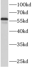      anti-ACSF2 antibody