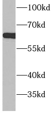 anti-ACSM5 antibody