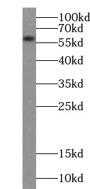 anti- ACSM3 antibody