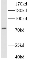 anti-ACSL3 antibody