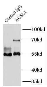      anti- ACSL1 antibody